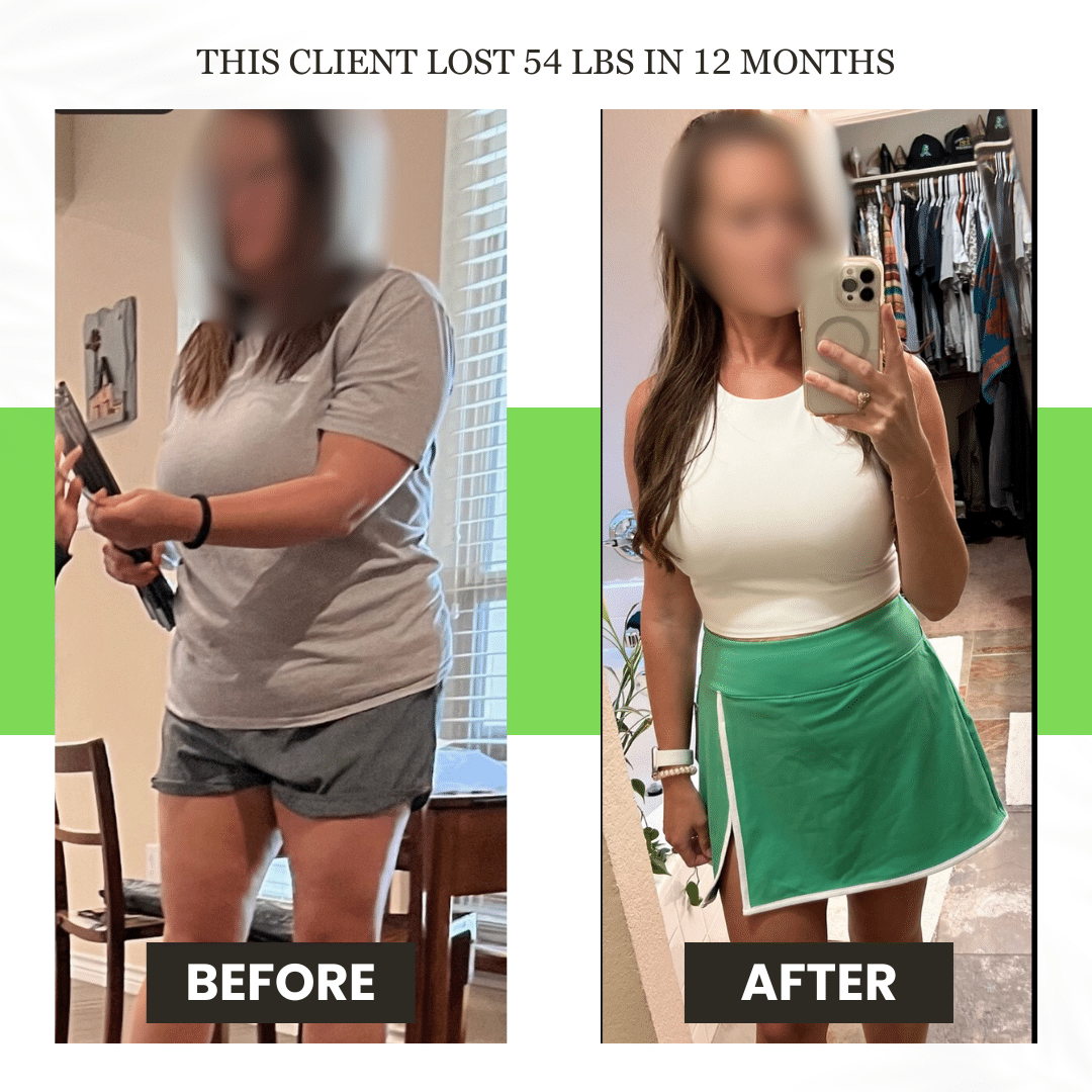 beforeafter photo 715